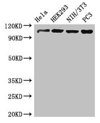 Western Blot  | Positive WB detected in: Hela whole cell lysate, HEK293 whole cell lysate, NIH/3T3 whole cell lysate, PC-3 whole cell lysate  | All lanes: NUP107 antibody at 3.4µg/ml  | Secondary  | Goat polyclonal to rabbit IgG at 1/50000 dilution  | Predicted band size: 107, 104, 80 kDa  | Observed band size: 107 kDaRabbit anti-Human NUP107 Polyclonal Antibody