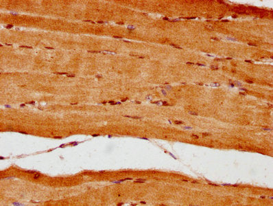 IHC image of NUP62 Antibody diluted at 1:300 and staining in paraffin-embedded human skeletal muscle tissue performed on a Leica BondTM system. After dewaxing and hydration, antigen retrieval was mediated by high pressure in a citrate buffer (pH 6.0). Section was blocked with 10% normal goat serum 30min at RT. Then primary antibody (1% BSA) was incubated at 4°C overnight. The primary is detected by a biotinylated secondary antibody and visualized using an HRP conjugated SP system.Rabbit anti-Human NUP62 Polyclonal Antibody