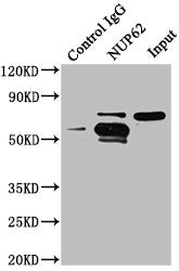 Immunoprecipitating NUP62 in A549 whole cell lysate | Lane 1: Rabbit control IgG instead of NUP62 Antibody in A549 whole cell lysate. | For western blotting, a HRP-conjugated Protein G antibody was used as the secondary antibody (1/50000) | Lane 2: NUP62 Antibody (6μg) + A549 whole cell lysate (1mg) | Lane 3: A549 whole cell lysate (20μg)Rabbit anti-Human NUP62 Polyclonal Antibody
