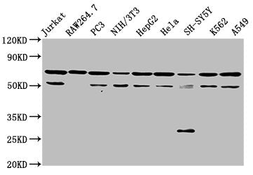 Western Blot | Positive WB detected in: Jurkat whole cell lysate, RAW264.7 whole cell lysate, PC-3 whole cell lysate, NIH/3T3 whole cell lysate, HepG2 whole cell lysate, Hela whole cell lysate, SH-SY5Y whole cell lysate, K562 whole cell lysate, A549 whole cell lysate | All lanes: NUP62 antibody at 3.5μg/ml | Secondary | Goat polyclonal to rabbit IgG at 1/50000 dilution | Predicted band size: 54 kDa | Observed band size: 62 kDaRabbit anti-Human NUP62 Polyclonal Antibody