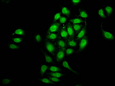 Immunofluorescence staining of A549 cells with NUP98 Antibody at 1:100, counter-stained with DAPI. The cells were fixed in 4% formaldehyde, permeabilized using 0.2% Triton X-100 and blocked in 10% normal Goat Serum. The cells were then incubated with the antibody overnight at 4°C. The secondary antibody was Alexa Fluor 488-congugated AffiniPure Goat Anti-Rabbit IgG(H+L).Rabbit anti-Human NUP98 Polyclonal Antibody