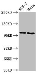 Western Blot | Positive WB detected in: MCF-7 whole cell lysate, Hela whole cell lysate | All lanes: NUP98 antibody at 3.2μg/ml | Secondary | Goat polyclonal to rabbit IgG at 1/50000 dilution | Predicted band size: 198, 188, 98, 97, 196, 187 kDa | Observed band size: 105 kDaRabbit anti-Human NUP98 Polyclonal Antibody