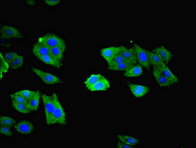 Immunofluorescent analysis of HepG2 cells using NXF5 Antibody at dilution of 1:100 and Alexa Fluor 488-congugated AffiniPure Goat Anti-Rabbit IgG(H+L)Rabbit anti-Human NXF5 Polyclonal Antibody