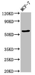 Western Blot | Positive WB detected in: MCF-7 whole cell lysate | All lanes: OCLN antibody at 3.2μg/ml | Secondary | Goat polyclonal to rabbit IgG at 1/50000 dilution | Predicted band size: 60, 53, 55, 32, 24, 9 kDa | Observed band size: 60 kDaRabbit anti-Human OCLN Polyclonal Antibody