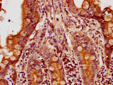 IHC image of ACTB Antibody diluted at 1:500 and staining in paraffin-embedded human small intestine tissue performed on a Leica BondTM system. After dewaxing and hydration, antigen retrieval was mediated by high pressure in a citrate buffer (pH 6.0). Section was blocked with 10% normal goat serum 30min at RT. Then primary antibody (1% BSA) was incubated at 4°C overnight. The primary is detected by a biotinylated secondary antibody and visualized using an HRP conjugated SP system.