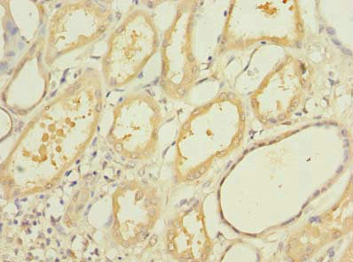 Immunohistochemistry of paraffin-embedded human kidney tissue using OGG1 Antibody at dilution of 1:100Rabbit anti-Human OGG1 Polyclonal Antibody
