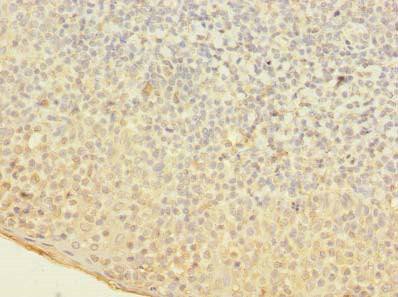 Immunohistochemistry of paraffin-embedded human tonsil tissue using OGG1 Antibody at dilution of 1:100Rabbit anti-Human OGG1 Polyclonal Antibody
