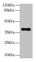Western blot  | All lanes: OGG1 antibody at 6µg/ml + Hela whole cell lysate  | Secondary  | Goat polyclonal to rabbit IgG at 1/10000 dilution  | Predicted band size: 39, 37, 46, 48, 40, 23, 41 kDa  | Observed band size: 39 kDaRabbit anti-Human OGG1 Polyclonal Antibody