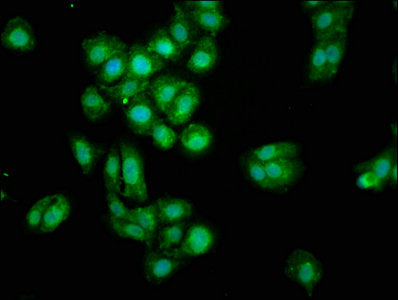 Immunofluorescence staining of HepG2 cells with OGN Antibody at 1:100, counter-stained with DAPI. The cells were fixed in 4% formaldehyde, permeabilized using 0.2% Triton X-100 and blocked in 10% normal Goat Serum. The cells were then incubated with the antibody overnight at 4°C. The secondary antibody was Alexa Fluor 488-congugated AffiniPure Goat Anti-Rabbit IgG(H+L).Rabbit anti-Human OGN Polyclonal Antibody