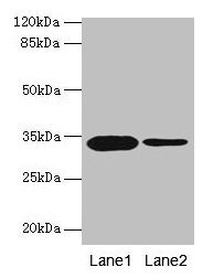 Western blot  | All lanes: OGN antibody at 14µg/ml  | Lane 1: Rat liver tissue  | Lane 2: 293T whole cell lysate  | Secondary  | Goat polyclonal to rabbit IgG at 1/10000 dilution  | Predicted band size: 34 kDa  | Observed band size: 34 kDaRabbit anti-Human OGN Polyclonal Antibody