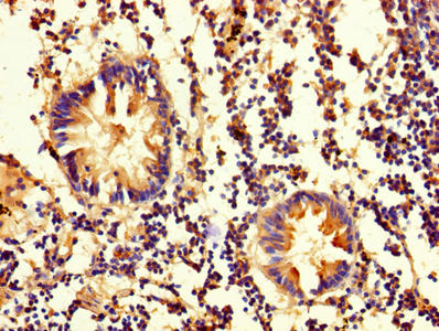 Immunohistochemistry of paraffin-embedded human appendix tissue using OLA1 Antibody at dilution of 1:100Rabbit anti-Human OLA1 Polyclonal Antibody