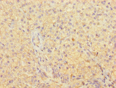 Immunohistochemistry of paraffin-embedded human adrenal gland tissue using OLA1 Antibody at dilution of 1:100Rabbit anti-Human OLA1 Polyclonal Antibody