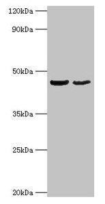 Western blot  | All lanes: OLA1 antibody at 2µg/ml  | Lane 1: HepG2 whole cell lysate  | Lane 2: Mouse stomach tissue  | Secondary  | Goat polyclonal to rabbit IgG at 1/10000 dilution  | Predicted band size: 45, 28, 32 kDa  | Observed band size: 45 kDaRabbit anti-Human OLA1 Polyclonal Antibody