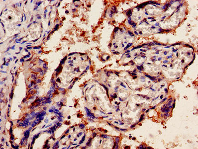 IHC image of OLR1 Antibody diluted at 1:1200 and staining in paraffin-embedded human placenta tissue performed on a Leica BondTM system. After dewaxing and hydration, antigen retrieval was mediated by high pressure in a citrate buffer (pH 6.0). Section was blocked with 10% normal goat serum 30min at RT. Then primary antibody (1% BSA) was incubated at 4°C overnight. The primary is detected by a biotinylated secondary antibody and visualized using an HRP conjugated SP system.Rabbit anti-Human OLR1 Polyclonal Antibody