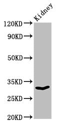 Western Blot  | Positive WB detected in: Rat kidney tissue  | All lanes: OLR1 antibody at 3µg/ml  | Secondary  | Goat polyclonal to rabbit IgG at 1/50000 dilution  | Predicted band size: 31, 21, 22 kDa  | Observed band size: 31 kDaRabbit anti-Human OLR1 Polyclonal Antibody