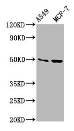 Western Blot  | Positive WB detected in: A549 whole cell lysate, MCF-7 whole cell lysate  | All lanes: OMD antibody at 3.5µg/ml  | Secondary  | Goat polyclonal to rabbit IgG at 1/50000 dilution  | Predicted band size: 50 kDa  | Observed band size: 50 kDaRabbit anti-Human OMD Polyclonal Antibody