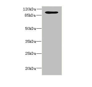 Western blot  | All lanes: OPHN1 antibody at 1.87μg/ml + A549 whole cell lysate  | Secondary  | Goat polyclonal to rabbit IgG at 1/10000 dilution  | Predicted band size: 92, 37 kDa  | Observed band size: 92 kDaRabbit anti-Human OPHN1 Polyclonal Antibody