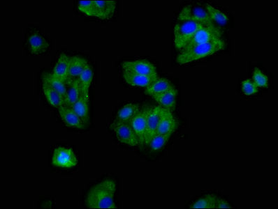 Immunofluorescence staining of HepG2 cells with OPRM1 Antibody at 1:166, counter-stained with DAPI. The cells were fixed in 4% formaldehyde, permeabilized using 0.2% Triton X-100 and blocked in 10% normal Goat Serum. The cells were then incubated with the antibody overnight at 4°C. The secondary antibody was Alexa Fluor 488-congugated AffiniPure Goat Anti-Rabbit IgG(H+L).Rabbit anti-Human OPRM1 Polyclonal Antibody