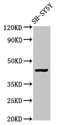 Western Blot  | Positive WB detected in: SH-SY5Y whole cell lysate  | All lanes: OPRM1 antibody at 2.9µg/ml  | Secondary  | Goat polyclonal to rabbit IgG at 1/50000 dilution  | Predicted band size: 45, 44, 50, 48, 46, 56, 35, 37, 34, 14, 11, 21 kDa  | Observed band size: 45 kDaRabbit anti-Human OPRM1 Polyclonal Antibody