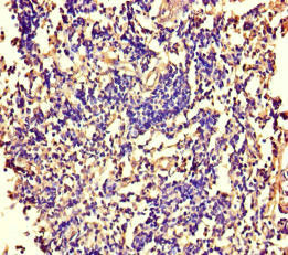 Immunohistochemistry of paraffin-embedded human tonsil tissue using ARAF Antibody at dilution of 1:100Rabbit anti-Human ARAF Polyclonal Antibody