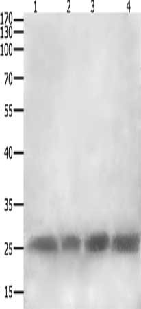 Gel: 12+15%SDS-PAGE, Lysate: 40 μg, Lane 1-4: RAW264.7, Hela cells, 823 cells, A549 cells, Primary antibody: CLEC4A Antibody(CLEC4A Antibody) at dilution 1/300, Secondary antibody: Goat anti rabbit IgG at 1/8000 dilution, Exposure time: 10 minutesRabbit anti-Human CLEC4A Polyclonal Antibody