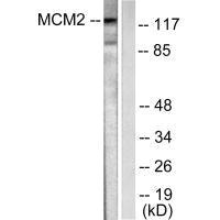Western blot analysis of extracts from 293 cells, using MCM2 antibody.