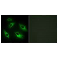 Immunofluorescence analysis of HeLa cells, using EPHB6 antibody.Rabbit anti-Human EPHB6 Polyclonal Antibody