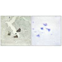 Immunohistochemistry analysis of paraffin-embedded human brain tissue using EPHB6 antibody.Rabbit anti-Human EPHB6 Polyclonal Antibody
