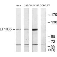 Western blot analysis of extracts from HeLa cells, 293 cells and COLO cells, using EPHB6 antibody.Rabbit anti-Human EPHB6 Polyclonal Antibody