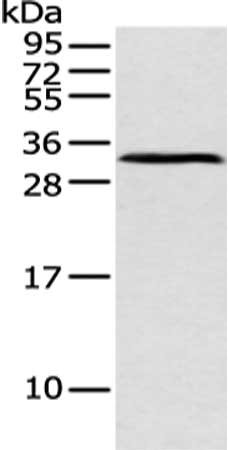 Gel: 12%SDS-PAGE, Lysate: 40 μg, Lane: Mouse pancreas tissue, Primary antibody: ATP4B Antibody(ATP4B Antibody) at dilution 1/250 dilution, Secondary antibody: Goat anti rabbit IgG at 1/8000 dilution, Exposure time: 1 minute