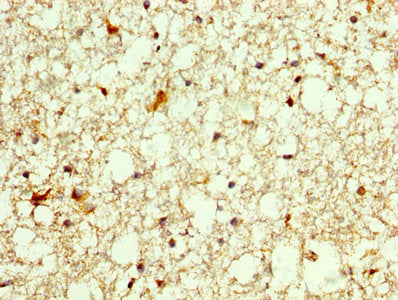 IHC image of OTX2 Antibody diluted at 1:250 and staining in paraffin-embedded human brain tissue performed on a Leica BondTM system. After dewaxing and hydration, antigen retrieval was mediated by high pressure in a citrate buffer (pH 6.0). Section was blocked with 10% normal goat serum 30min at RT. Then primary antibody (1% BSA) was incubated at 4°C overnight. The primary is detected by a biotinylated secondary antibody and visualized using an HRP conjugated SP system.Rabbit anti-Human OTX2 Polyclonal Antibody