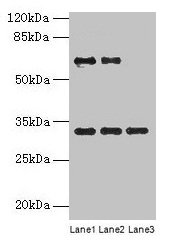 Western blot  | All lanes: OTX2 antibody at 4µg/ml  | Lane 1: Jurkat whole cell lysate  | Lane 2: Hela whole cell lysate  | Lane 3: Mouse lung tissue  | Secondary  | Goat polyclonal to rabbit IgG at 1/10000 dilution  | Predicted band size: 32, 33 kDa  | Observed band size: 32 kDaRabbit anti-Human OTX2 Polyclonal Antibody