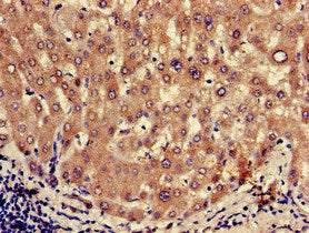 Immunohistochemistry of paraffin-embedded human liver tissue using OXT Antibody at dilution of 1:100Rabbit anti-Human OXT Polyclonal Antibody