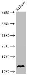 Western Blot | Positive WB detected in: Mouse kidney tissue | All lanes: OXT antibody at 3.4μg/ml | Secondary | Goat polyclonal to rabbit IgG at 1/50000 dilution | Predicted band size: 13 kDa | Observed band size: 13 kDaRabbit anti-Human OXT Polyclonal Antibody