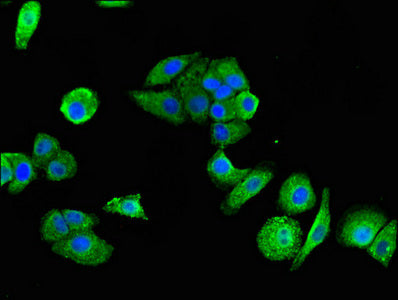 Immunofluorescent analysis of HepG2 cells using P2RX1 Antibody at dilution of 1:100 and Alexa Fluor 488-congugated AffiniPure Goat Anti-Rabbit IgG(H+L)Rabbit anti-Human P2RX1 Polyclonal Antibody