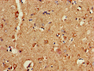 Immunohistochemistry of paraffin-embedded human brain tissue using P2RX1 Antibody at dilution of 1:100Rabbit anti-Human P2RX1 Polyclonal Antibody