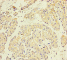 Immunohistochemistry of paraffin-embedded human pancreatic tissue using P2RX3 Antibody at dilution of 1:100Rabbit anti-Human P2RX3 Polyclonal Antibody