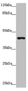 Western blot | All lanes: P2RX3 antibody at 3.91 μg/ml + Mouse liver tissue | Secondary | Goat polyclonal to rabbit IgG at 1/10000 dilution | Predicted band size: 44 kDa | Observed band size: 44 kDaRabbit anti-Human P2RX3 Polyclonal Antibody