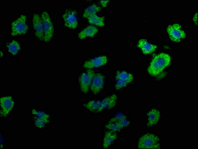 Immunofluorescence staining of HepG2 cells with LPAR6 Antibody at 1:100, counter-stained with DAPI. The cells were fixed in 4% formaldehyde, permeabilized using 0.2% Triton X-100 and blocked in 10% normal Goat Serum. The cells were then incubated with the antibody overnight at 4°C. The secondary antibody was Alexa Fluor 488-congugated AffiniPure Goat Anti-Rabbit IgG(H+L).
