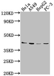 Western Blot | Positive WB detected in: Hela whole cell lysate, A549 whole cell lysate, HepG2 whole cell lysate, PC-3 whole cell lysate | All lanes: LPAR6 antibody at 1:2000 | Secondary | Goat polyclonal to rabbit IgG at 1/50000 dilution | Predicted band size: 40 kDa | Observed band size: 40 kDa