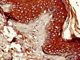 Immunohistochemistry of paraffin-embedded human skin tissue using P4HA1 Antibody at dilution of 1:100Rabbit anti-Human P4HA1 Polyclonal Antibody