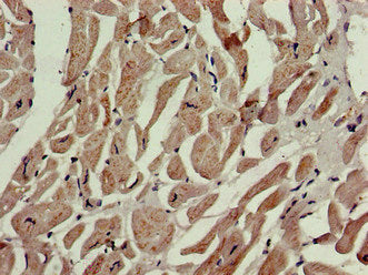 Immunohistochemistry of paraffin-embedded human heart tissue using P4HA1 Antibody at dilution of 1:100Rabbit anti-Human P4HA1 Polyclonal Antibody