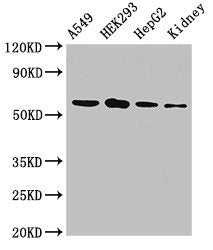 Western Blot | Positive WB detected in: A549 whole cell lysate, HEK293 whole cell lysate, HepG2 whole cell lysate, Rat kidney tissue | All lanes: P4HA1 antibody at 2.5μg/ml | Secondary | Goat polyclonal to rabbit IgG at 1/50000 dilution | Predicted band size: 62, 61, 59 kDa | Observed band size: 62 kDaRabbit anti-Human P4HA1 Polyclonal Antibody