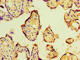 Immunohistochemistry of paraffin-embedded human placenta tissue using P4HA2 Antibody at dilution of 1:100Rabbit anti-Human P4HA2 Polyclonal Antibody