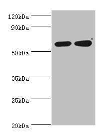 Western blot | All lanes: P4HA2 antibody at 6μg/ml | Lane 1: HepG2 whole cell lysate | Lane 2: 293T whole cell lysate | Secondary | Goat polyclonal to rabbit IgG at 1/10000 dilution | Predicted band size: 61 kDa | Observed band size: 61 kDaRabbit anti-Human P4HA2 Polyclonal Antibody
