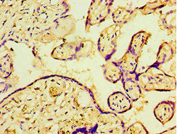Immunohistochemistry of paraffin-embedded human placenta tissue using P4HA2 Antibody at dilution of 1:100Rabbit anti-Human P4HA2 Polyclonal Antibody