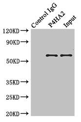 Immunoprecipitating P4HA2 in Hela whole cell lysate | Lane 1: Rabbit control IgG instead of (1μg) instead of P4HA2 Antibody in Hela whole cell lysate. | For western blotting, a HRP-conjugated anti-rabbit IgG, specific to the non-reduced form of IgG was used as the Secondary antibody (1/50000) | Lane 2: P4HA2 Antibody (4μg) + Hela whole cell lysate (500μg) | Lane 3: Hela whole cell lysate (20μg)Rabbit anti-Human P4HA2 Polyclonal Antibody