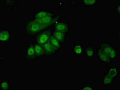 Immunofluorescent analysis of MCF-7 cells using the antibody at dilution of 1:100 and Alexa Fluor 488-congugated AffiniPure Goat Anti-Rabbit IgG(H+L)Rabbit anti-Human PAFAH1B2 Polyclonal Antibody