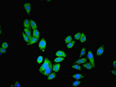 Immunofluorescent analysis of HepG2 cells using PAH Antibody at dilution of 1:100 and Alexa Fluor 488-congugated AffiniPure Goat Anti-Rabbit IgG(H+L)Rabbit anti-Human PAH Polyclonal Antibody