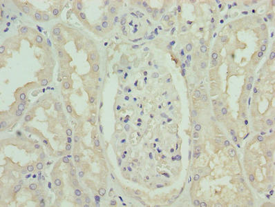 Immunohistochemistry of paraffin-embedded human kidney tissue using PAH Antibody at dilution of 1:100Rabbit anti-Human PAH Polyclonal Antibody